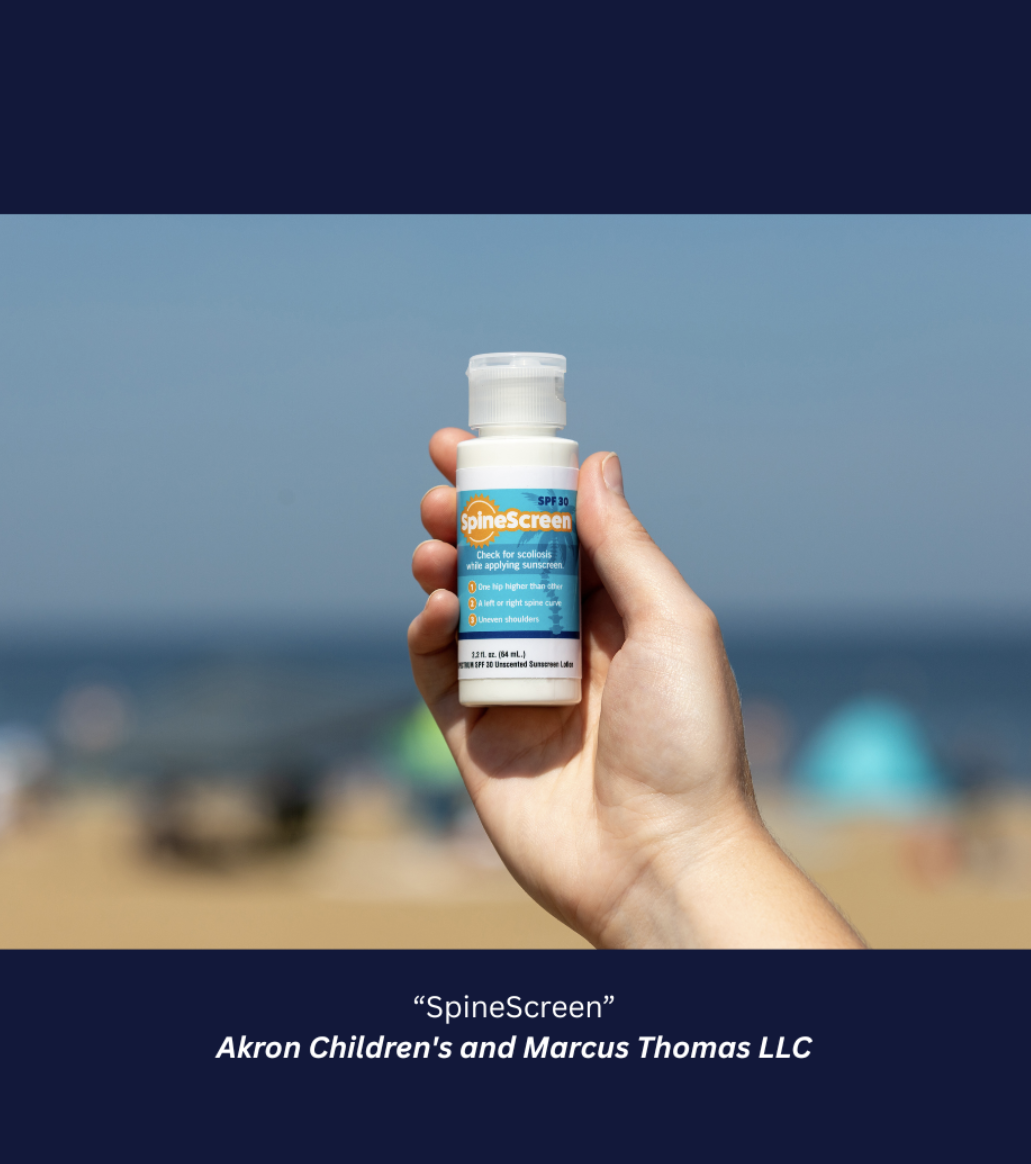 Hand holding a bottle of ‘SpineScreen’ SPF 30 sunscreen at the beach, designed to help check for signs of scoliosis while applying sunscreen, with ocean and umbrellas blurred in the background.