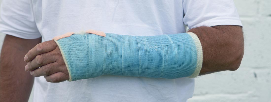 Man With A Broken Wrist. Find the best individual short term disability insurance.