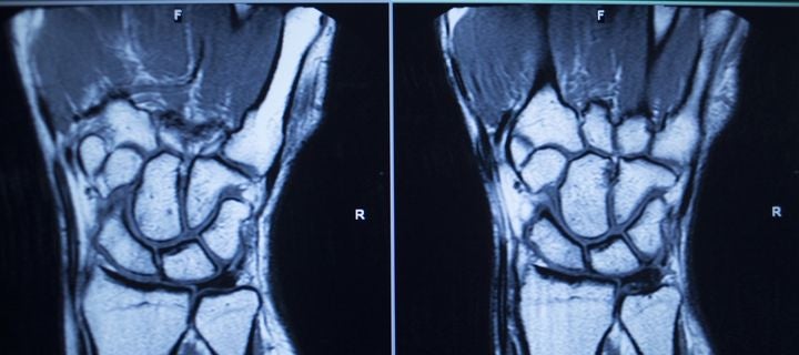 Hand and Wrist MRI | I-MED Radiology Network