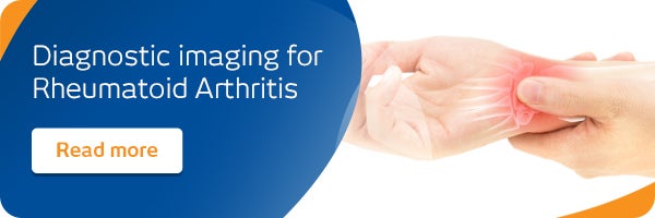 Rheumatoid arthritis