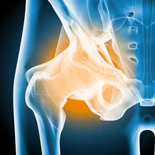Image of hip