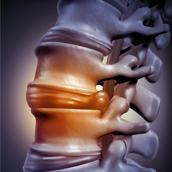 Image of spine