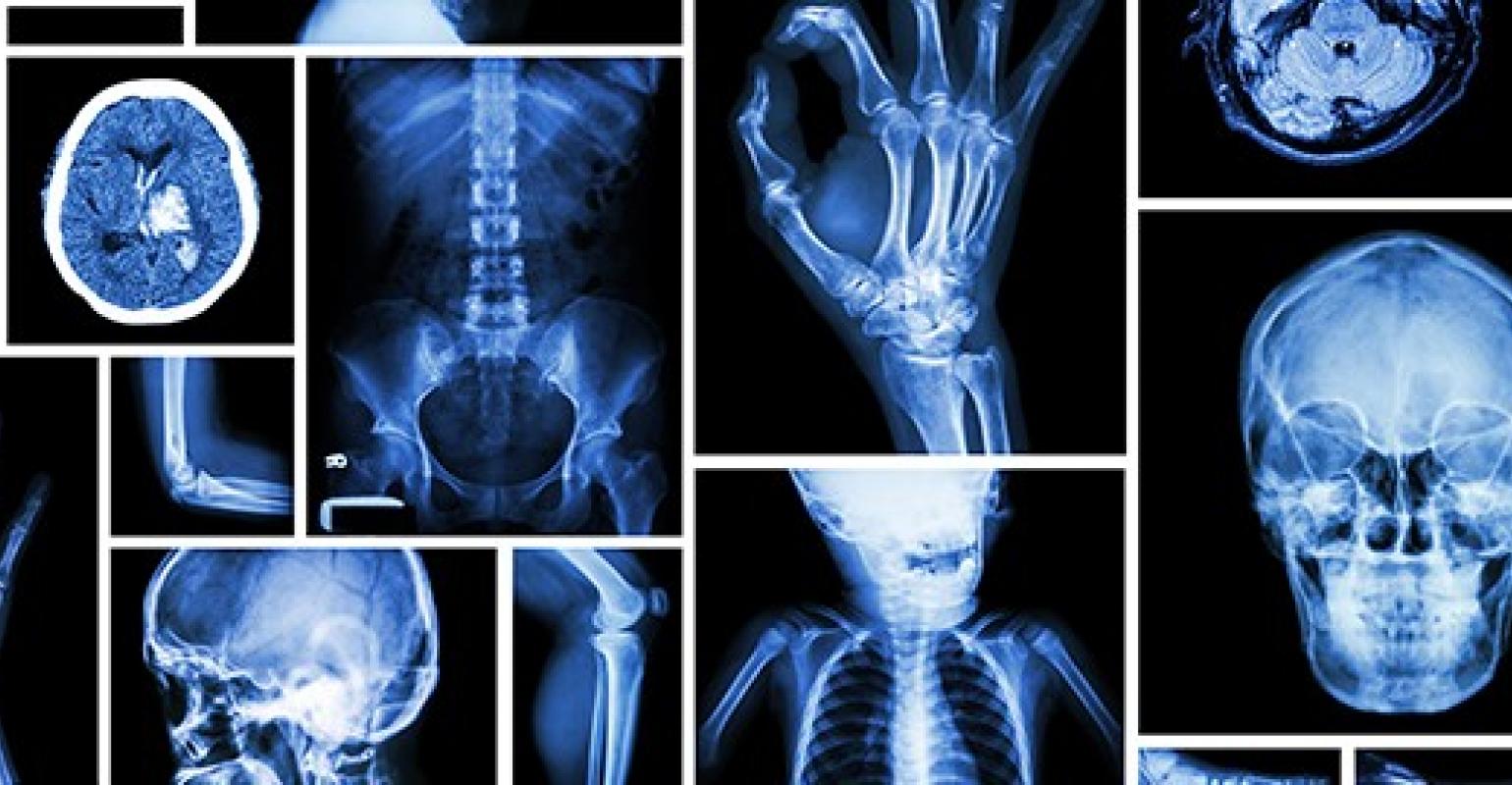 General x ray I MED Radiology Network