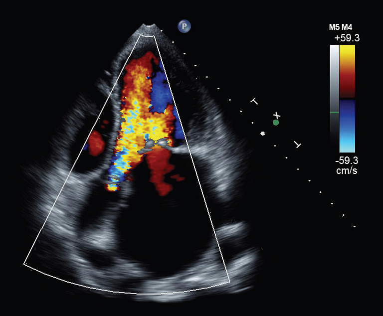 Echocardiography (Echo) Our cardiac services IMED Radiology Network