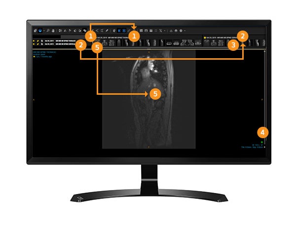How to view multiple images - computer