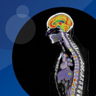 Leveraging PET-CT for enhanced clinical outcomes