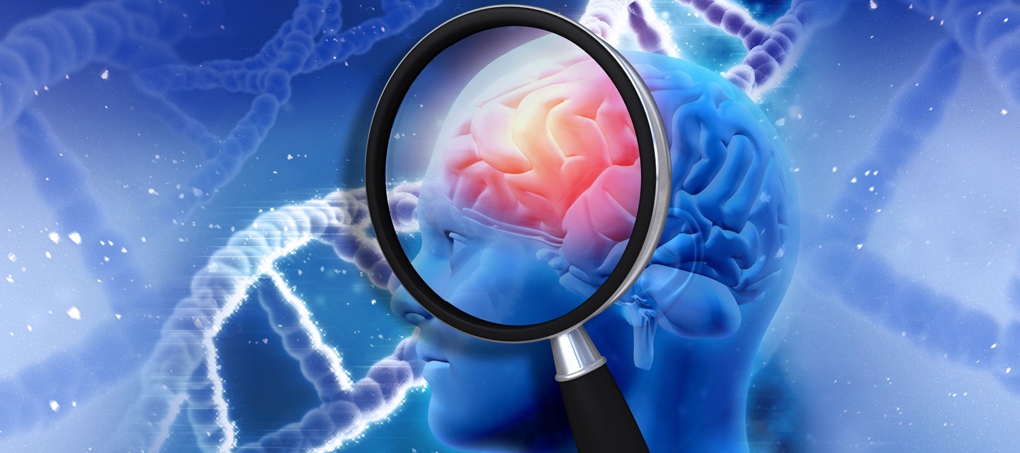 Brain Mri I Med Radiology Network Brain Mri I Med Radiology Network