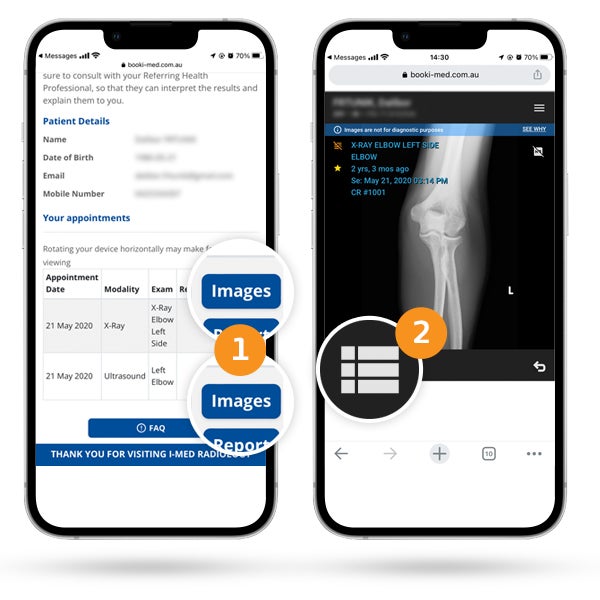 My I-MED patient results FAQ | I-MED Radiology Network