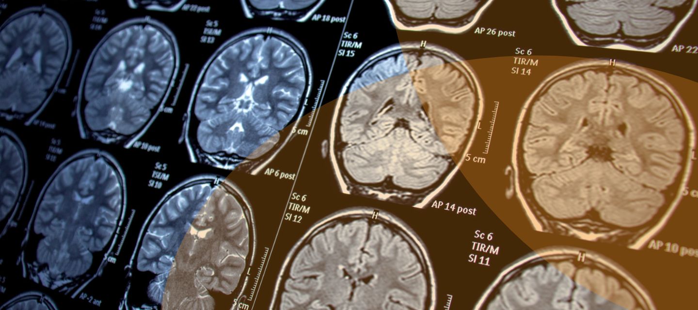 Magnetic Resonance Imaging