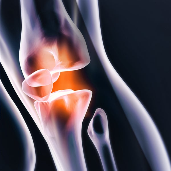 Musculoskeletal (MSK) imaging | I-MED Radiology Network