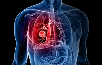 Computer graphic of internal organs