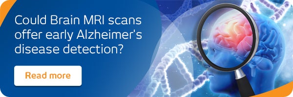 Could Brain MRI scans offer early Alzheimer's disease detection