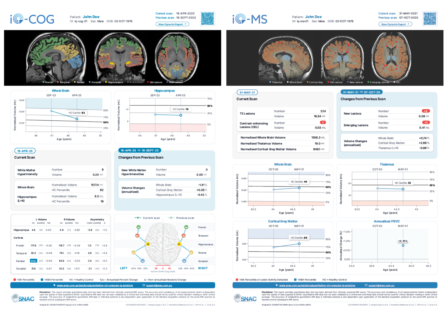 SNAC Quantitative Brain MRI