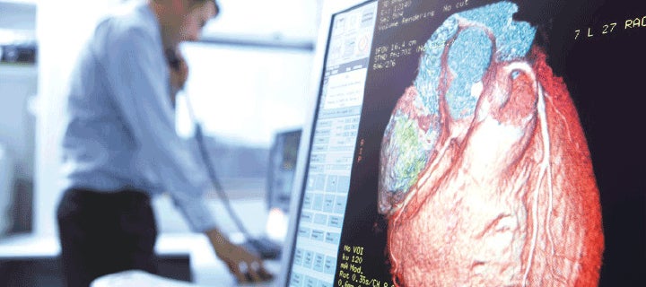 Doctor on the phone in background with large CT image of heart on screen