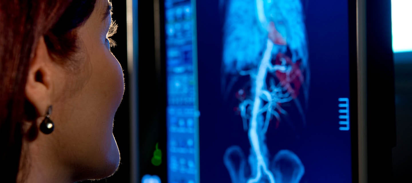 Radiologist looking at computer screen displaying cardiac imaging