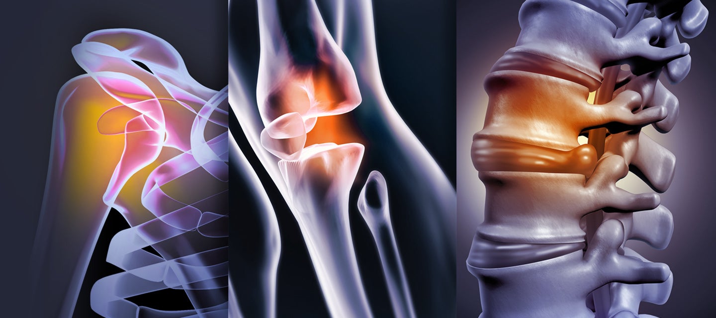 Shoulder Q & A with radiologist Dr Justin Roebert | I-MED Radiology Network