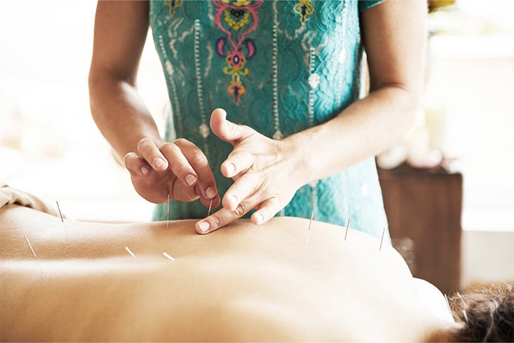 A person getting acupuncture alternative therapy