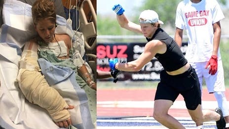 He nearly had his arm amputated, then broke his collarbone. None of that was going to stop Denton Guyer's Grayson O'Bara