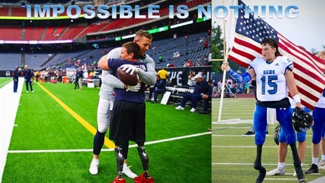 Calder Hodge: The Double Amputee Quarterback