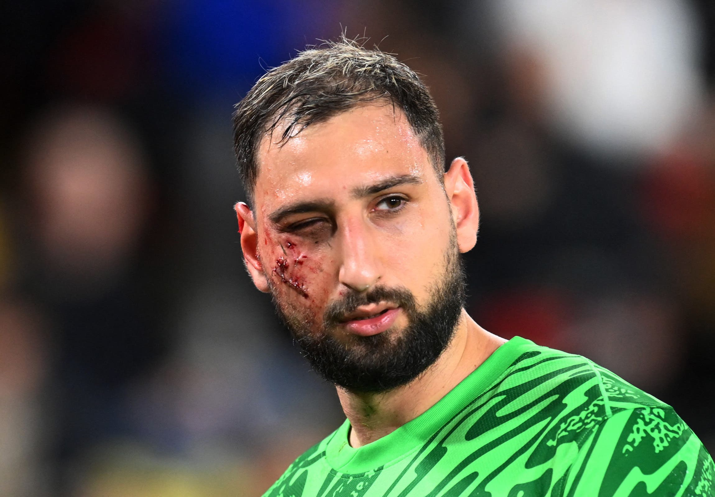 Donnarumma Returns After a Harrowing Kick to the Face | beIN SPORTS