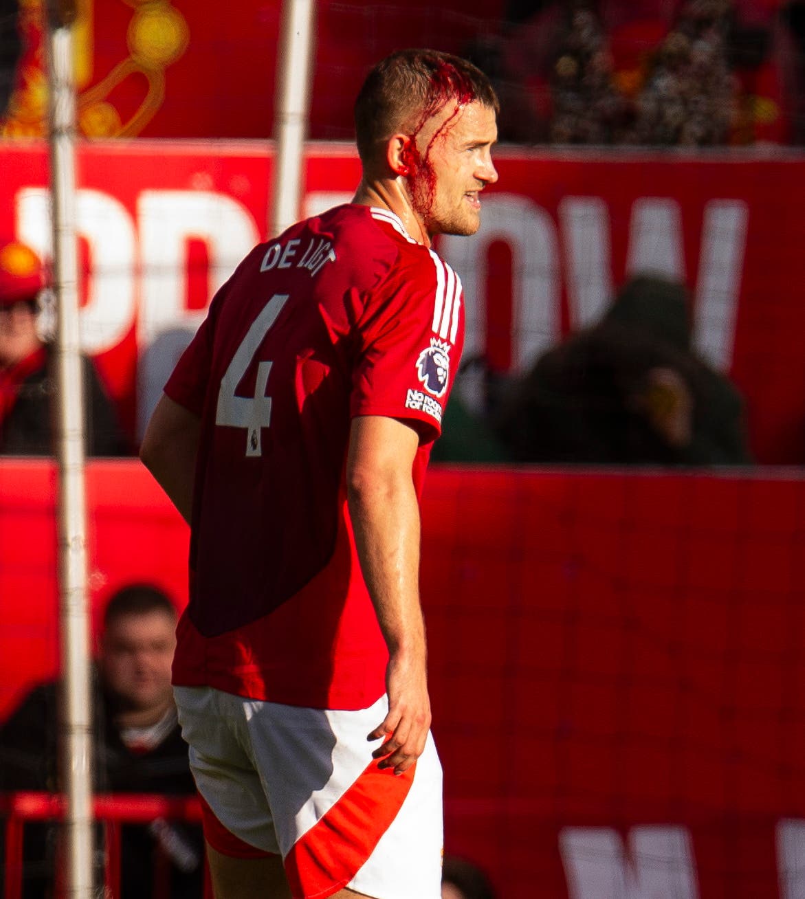 Manchester United: Why Was Matthijs De Ligt's Face Covered in Blood? | beIN SPORTS
