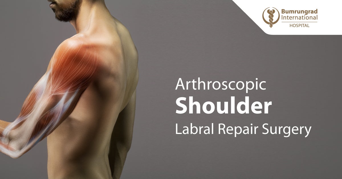 Arthroscopic shoulder labral repair surgery