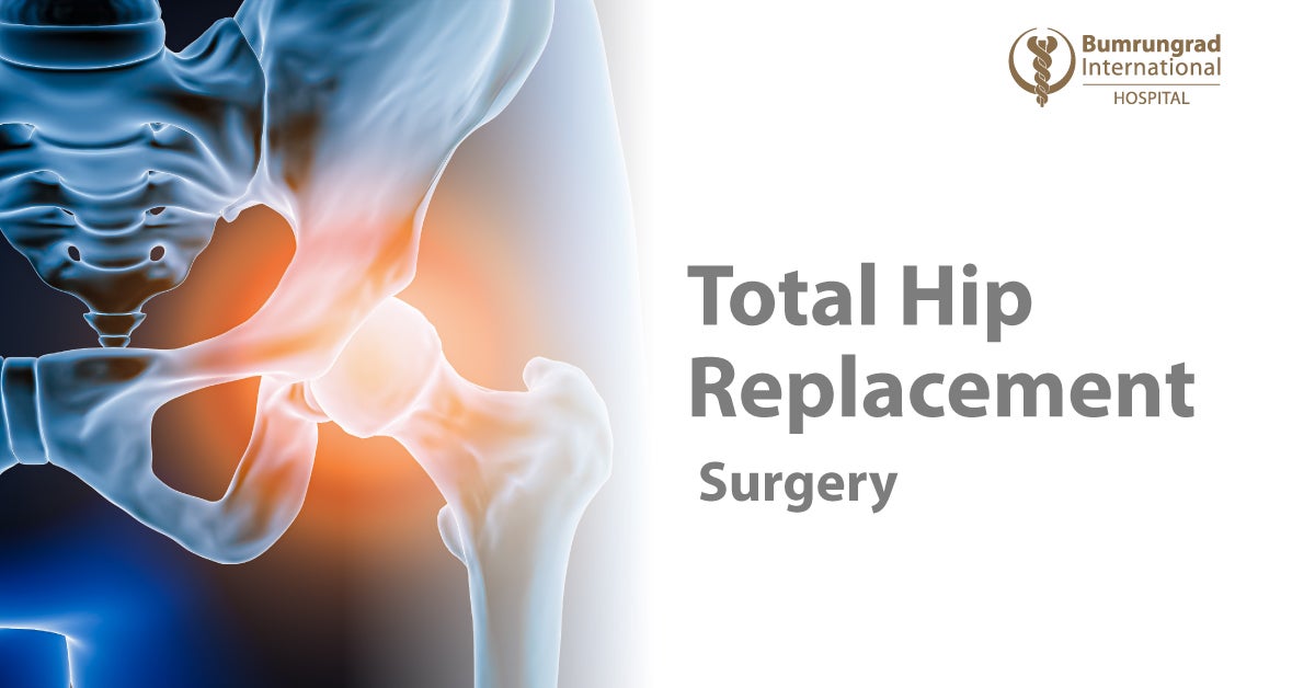 Total Hip Replacement Surgery