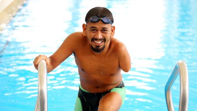 A young man with an amputated arm is smiling as he emerges from a swimming pool
