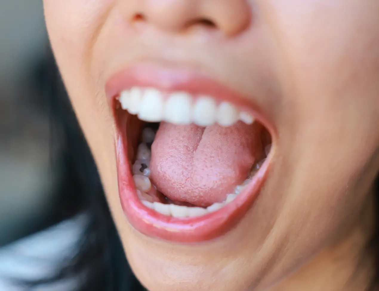 Can your tongue reveal a vitamin deficiency? All your tongue questions answered