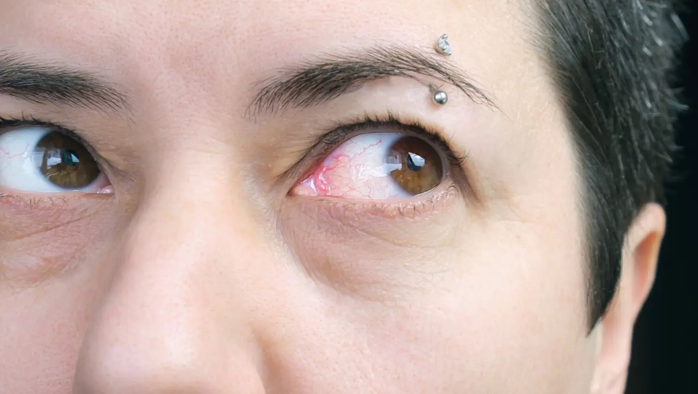 Red Veins in Your Eyes