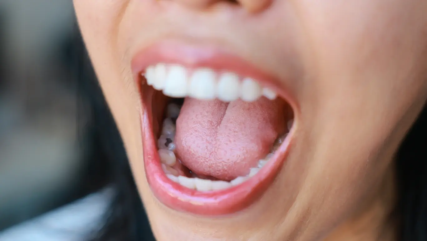 Can your tongue reveal a vitamin deficiency? All your tongue questions answered