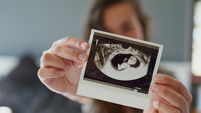 A woman holds out an ultrasound pic in front of her face. 