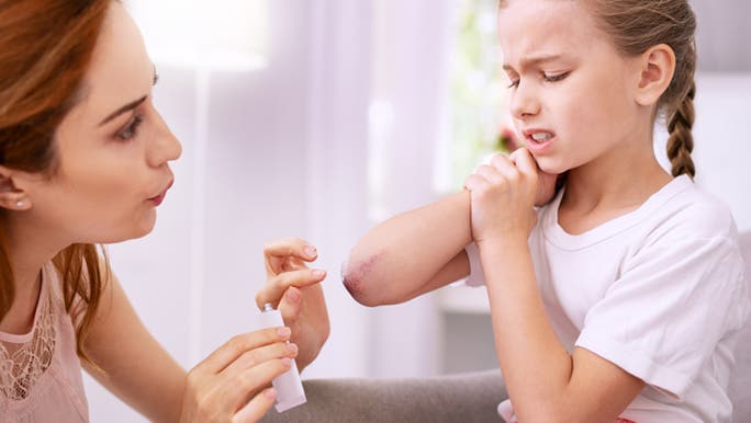A woman puts cream from the first aid kit on her daughter’s bruised elbow. 