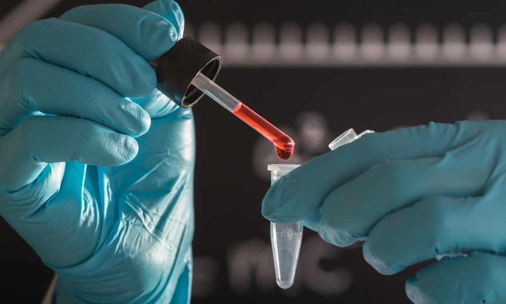 GAAP rules also set out how a company must treat money spent on research and development-min.jpg