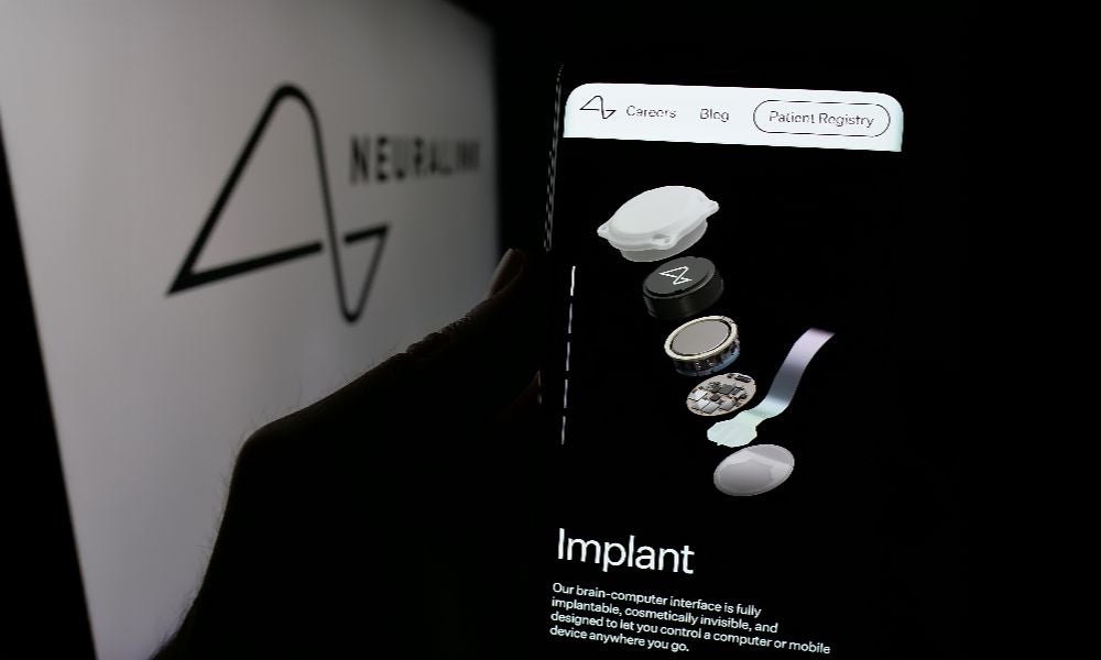 For brain-machine interface companies like Elon Musk’s Neuralink, precise neural targeting is critical.jpeg