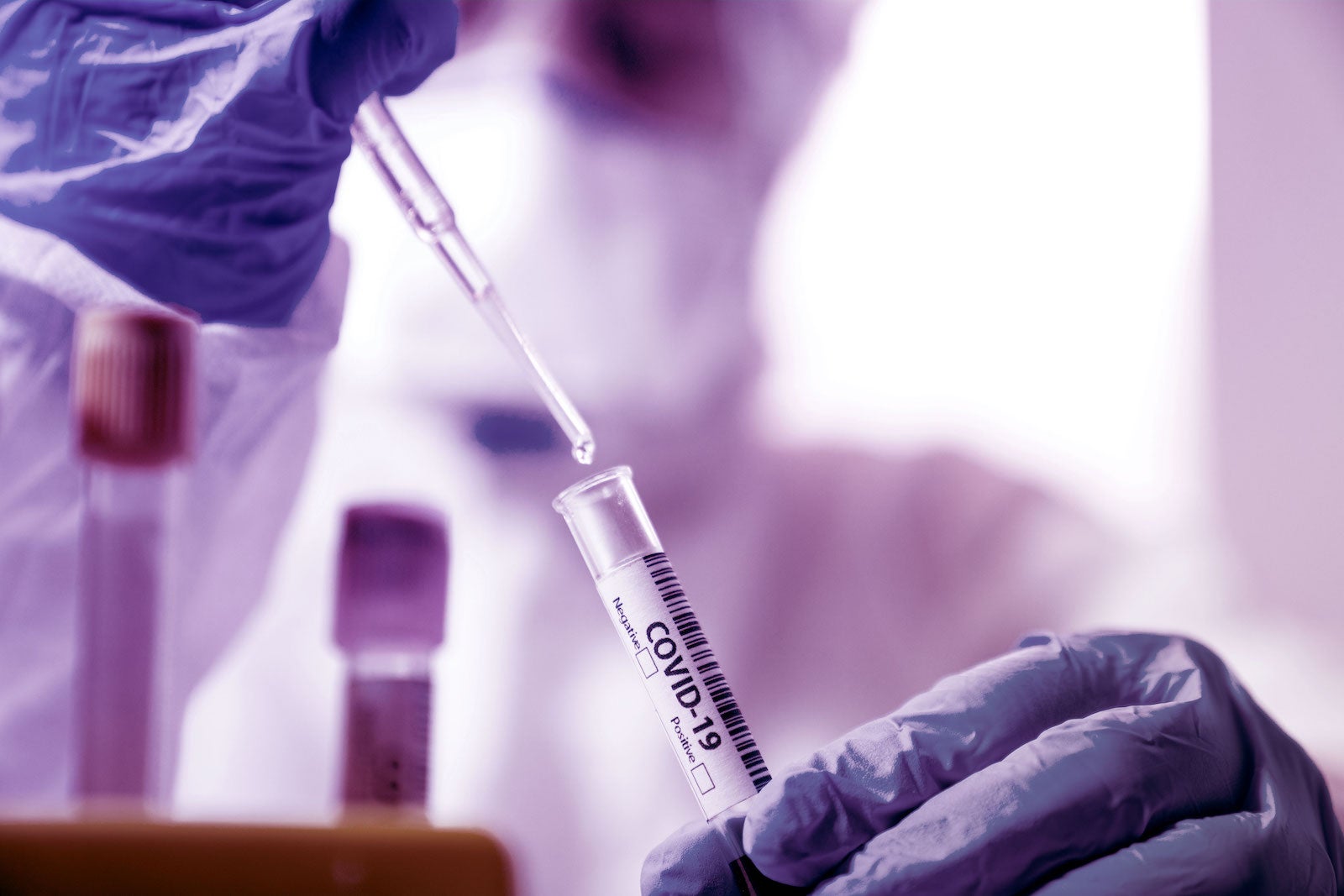 5 Million Xprize Rapid Covid Testing Competition To Acceler