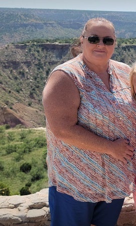 Vickie Pickreign before her weight loss surgery journey