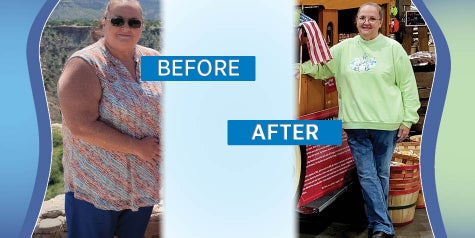 Vickie Pickreign side by side photos, before the surgery and after, showing weight loss and body differences