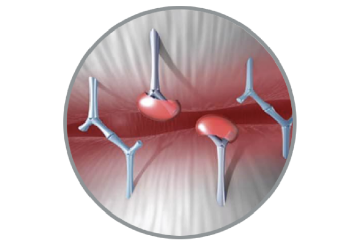 RESILIA Tissue Durabilityimg