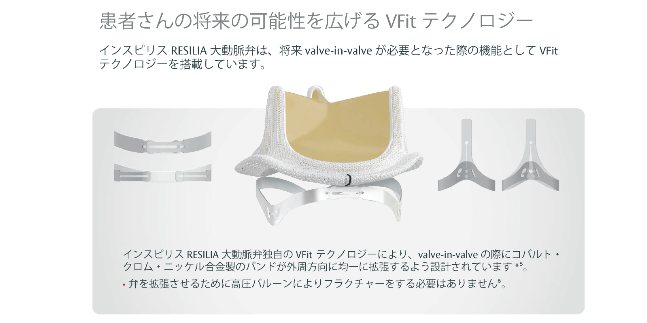 Expending patient possibilities with VFit technology