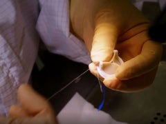  artificial heart valves