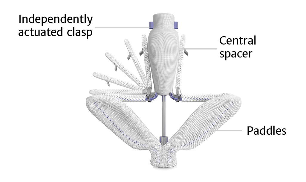 Image of PASCAL implant
