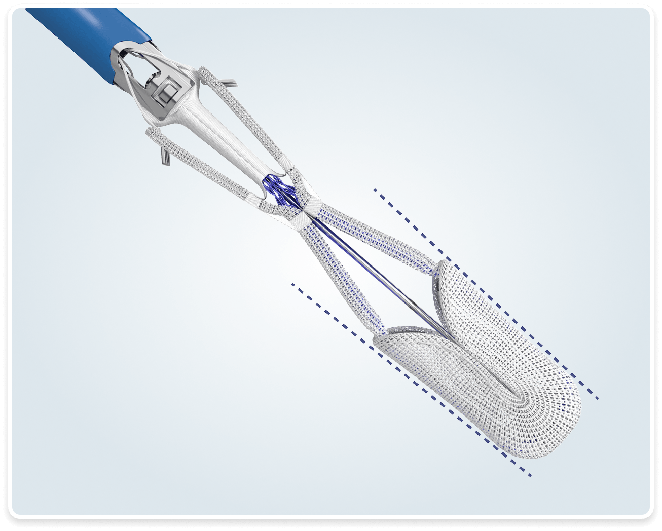 PASCAL Precision implant in its elongated, narrower profile