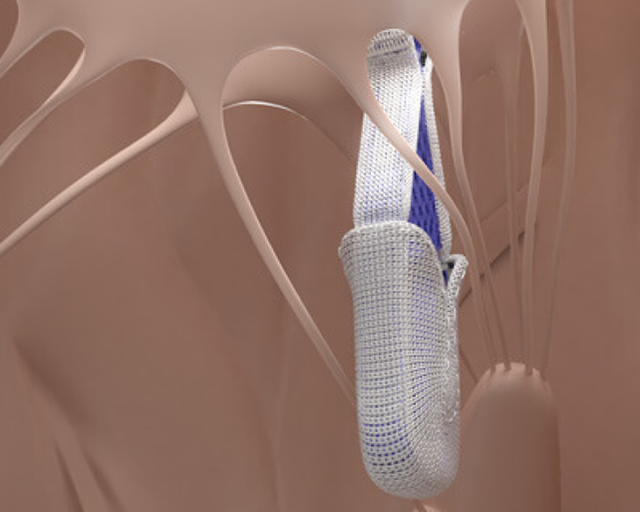 Pascal Edardws The PASCAL Precision system | Edwards Lifesciences