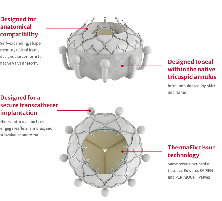 EVOQUE Tricuspid Valve Replacement | Edwards Lifesciences