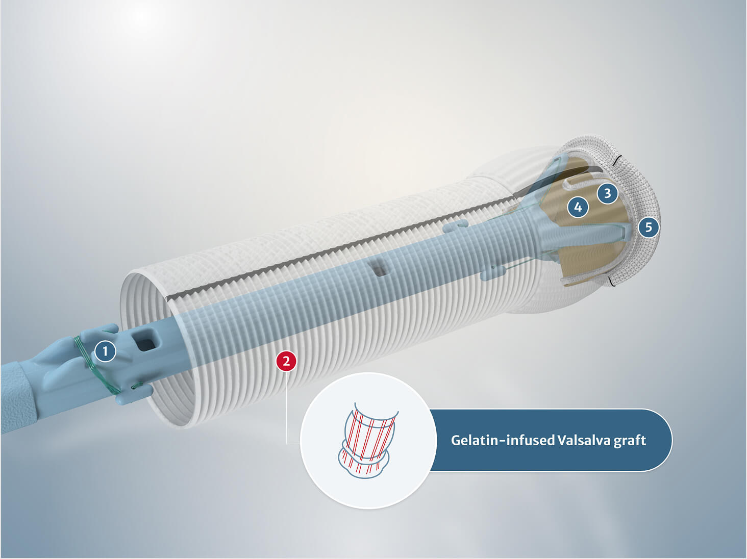 Gelatin-infused Valsalva graft