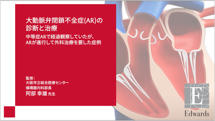 Learning from Case Studies Animation thumbnail