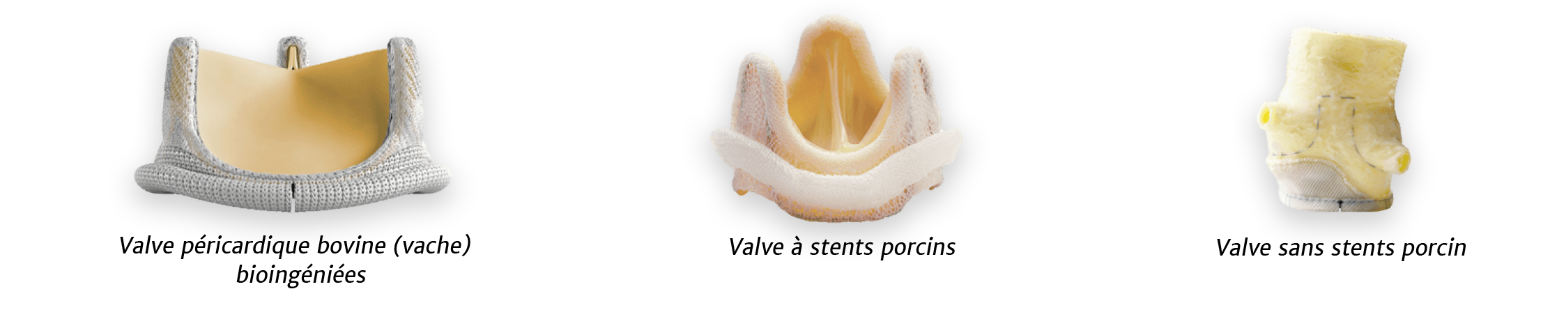 bioprosthetic valves