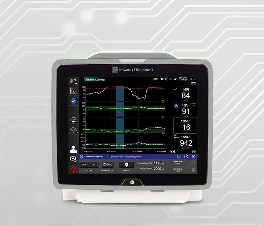 Acumen Assisted Fluid Management software Edwards Lifesciences