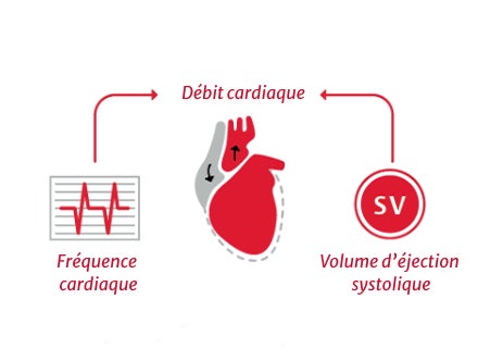 Cardiac Output (CO) = Stroke Volume x Heart Rate